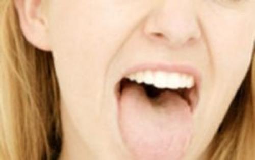 Налет на языке у взрослых. Грибковые, вирусные и бактериальные инфекции 05